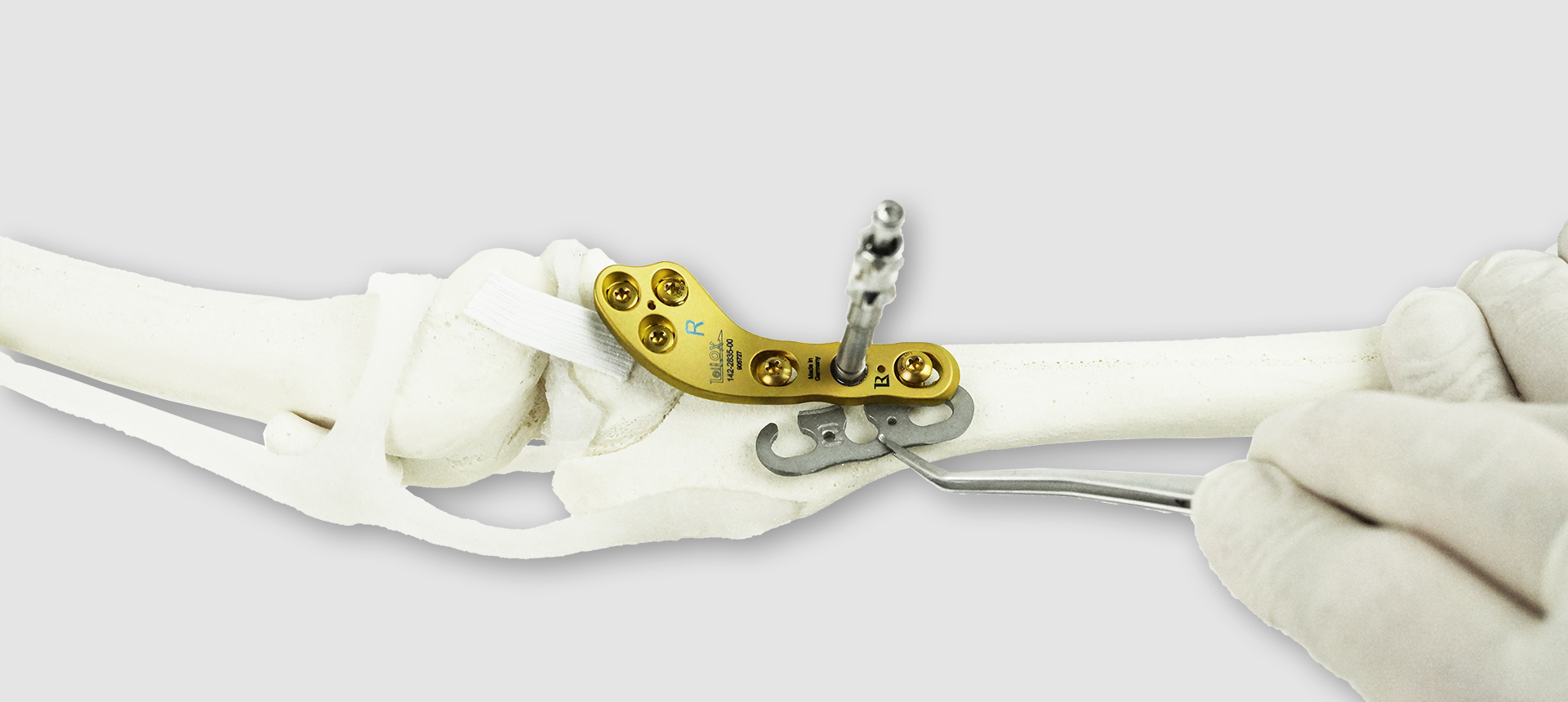 TPLO + Patella Luxation