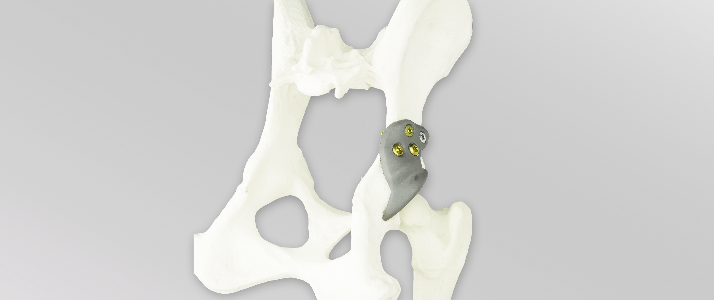 3D HIP