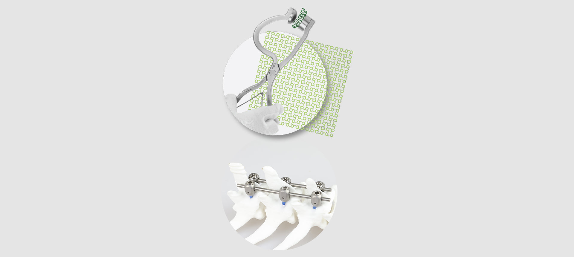 LeiPED Pedicle Screw System