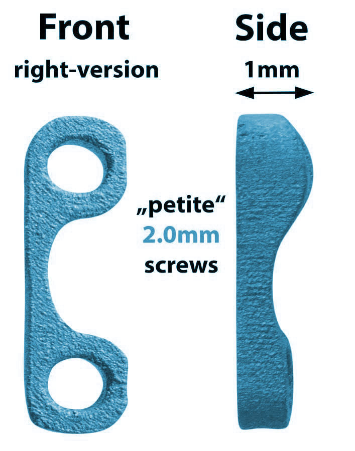 Patella Spacer