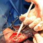 REDY Hydroxyapatitepaste