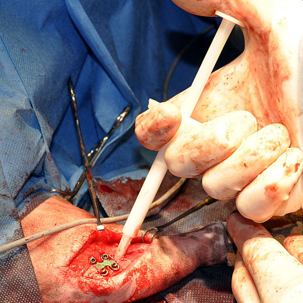 REDY Hydroxyapatitepaste