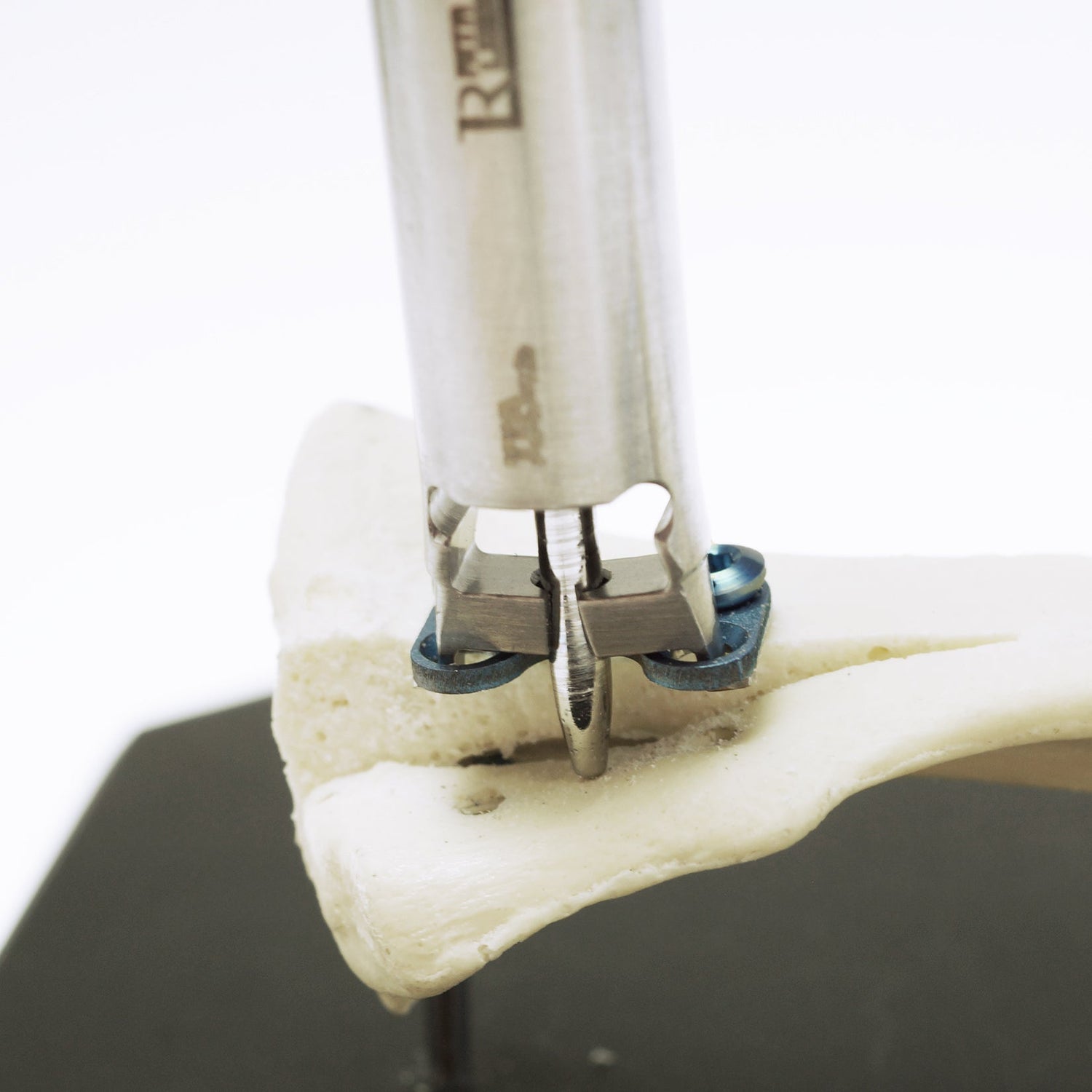 Tibia Tappet