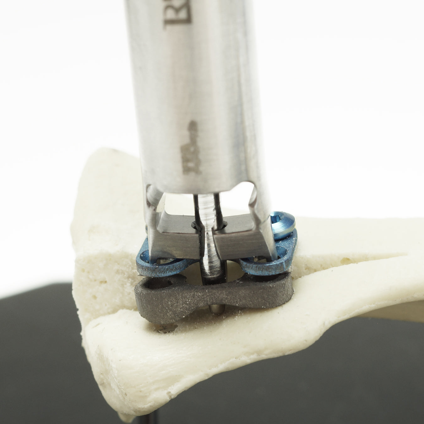 Tibia Tappet